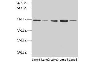Western blot All lanes: FNTB antibody at 6 μg/mL Lane 1: Hela whole cell lysate Lane 2: CEM whole cell lysate Lane 3: HepG2 whole cell lysate Lane 4: SH-SY5Y whole cell lysate Lane 5: A549 whole cell lysate Secondary Goat polyclonal to rabbit IgG at 1/10000 dilution Predicted band size: 49, 44 kDa Observed band size: 49 kDa