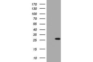 Image no. 1 for anti-BCL2/adenovirus E1B 19kDa Interacting Protein 1 (BNIP1) (AA 1-199) antibody (ABIN1490606) (BNIP1 Antikörper  (AA 1-199))