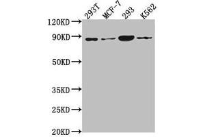 Western Blot Positive WB detected in: 293T whole cell lysate, MCF-7 whole cell lysate, 293 whole cell lysate, K562 whole cell lysate All lanes: P0C869 antibody at 1:2000 Secondary Goat polyclonal to rabbit IgG at 1/50000 dilution Predicted band size: 88, 101, 55, 115 kDa Observed band size: 88 kDa (PLA2G4B Antikörper  (AA 514-781))