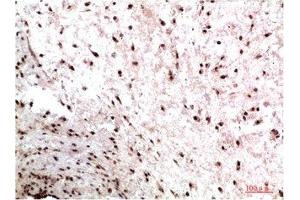 Immunohistochemical analysis of paraffin-embedded Human Colon Carcinoma Tissue using HP-1γ Mouse mAb diluted at 1:200. (CBX3 Antikörper)