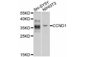 Western blot analysis of extracts of various cell lines, using CCND1 antibody (ABIN5995417) at 1/1000 dilution. (Cyclin D1 Antikörper)