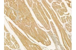 ABIN6262784 and ABIN6278914 at 1/100 staining human tongue carcinoma by IHC-P. (KRT23 Antikörper  (N-Term))