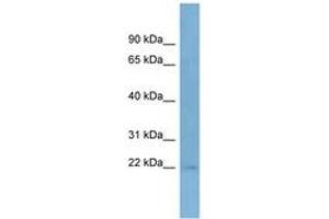 Image no. 1 for anti-Taspase, Threonine Aspartase, 1 (TASP1) (C-Term) antibody (ABIN6742150) (TASP1 Antikörper  (C-Term))