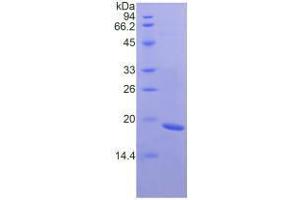 Image no. 1 for Fibronectin Type III Domain Containing 5 (FNDC5) (AA 2-137) (Active) protein (His tag) (ABIN6239744)