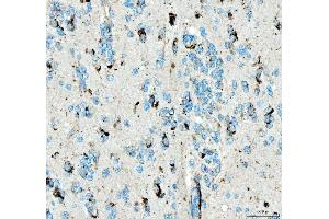 IHC analysis of SIAE using anti-SIAE antibody (ABIN7600774). (SIAE Antikörper  (AA 230-523))