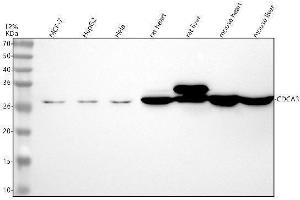 Western blot analysis of CDCA3 using anti-CDCA3 antibody (ABIN7604388).