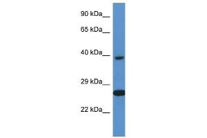 Western Blot showing XRCC3 antibody used at a concentration of 1 ug/ml against ACHN Cell Lysate (XRCC3 Antikörper  (C-Term))