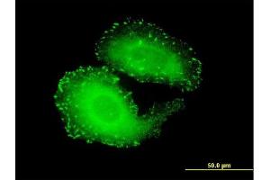 Immunofluorescence of monoclonal antibody to TNS4 on HeLa cell. (Tensin 4 Antikörper  (AA 1-480))