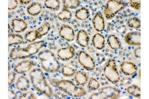 Anti- MMP9 Picoband antibody, IHC(P) IHC(P): Mouse Kidney Tissue