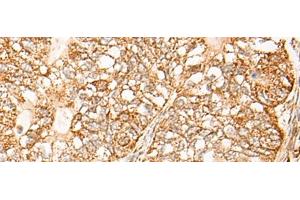 Immunohistochemistry (Paraffin-embedded Sections) (IHC (p)) image for anti-Nuclear Receptor Subfamily 0, Group B, Member 2 (NR0B2) antibody (ABIN7251844)