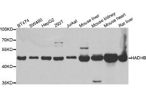 Western blot analysis of extracts of various cell lines, using HADHB antibody (ABIN5973344) at 1/1000 dilution. (HADHB Antikörper)