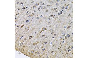 Immunohistochemistry of paraffin-embedded rat brain using DRD3 Antibody. (DRD3 Antikörper)