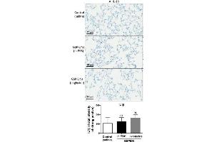 GSPIONs do not increase expression of pro-inflammatory cytokines in lung parenchyma. (IL-1 beta Antikörper  (AA 101-200))