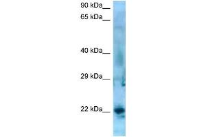 WB Suggested Anti-SSX5 Antibody   Titration: 1. (SSX5 Antikörper  (C-Term))