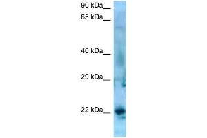 WB Suggested Anti-SSX5 Antibody   Titration: 1.