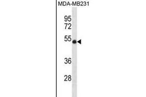 UBR7 Antikörper  (N-Term)