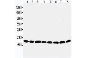 Western Blotting (WB) image for anti-Peroxiredoxin 5 (PRDX5) (AA 166-181), (C-Term) antibody (ABIN3044202) (Peroxiredoxin 5 Antikörper  (C-Term))