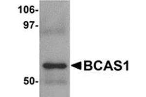 Western blot analysis of BCAS1 in human lung tissue lysate with BCAS1 antibody at 1 μg/ml. (BCAS1 Antikörper  (C-Term))
