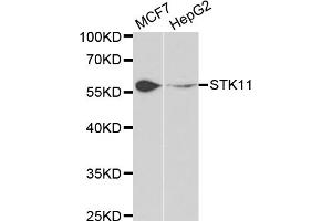 Western blot analysis of extracts of various cell lines, using STK11 antibody. (LKB1 Antikörper)