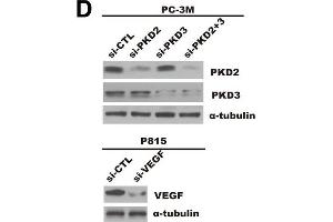 Prostate cancer cells-derived PKD2/3 promote chemotactic migration of mast cells and endothelial cells tube formation.