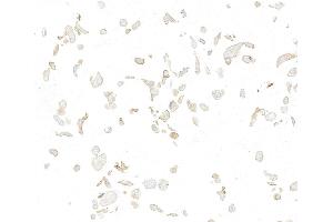 Immunocytochemistry (ICC) image for anti-Met Proto-Oncogene (MET) (C-Term) antibody (ABIN7795683) (Rekombinanter c-MET Antikörper  (C-Term))