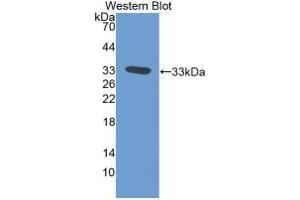 Detection of Recombinant TFPI, Rat using Monoclonal Antibody to Tissue Factor Pathway Inhibitor (TFPI) (TFPI Antikörper  (AA 29-302))