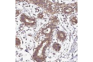 Immunohistochemical staining of human breast with OAS3 polyclonal antibody  shows moderate cytoplasmic positivity in glandular cells at 1:500-1:1000 dilution. (OAS3 Antikörper)