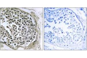 Immunohistochemistry analysis of paraffin-embedded human testis tissue, using GIDRP88 Antibody. (GIDRP88 Antikörper  (AA 721-770))