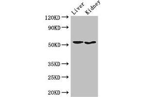 Western Blot Positive WB detected in: Mouse liver tissue, Mouse kidney tissue All lanes: SNX17 antibody at 3. (SNX17 Antikörper  (AA 280-457))