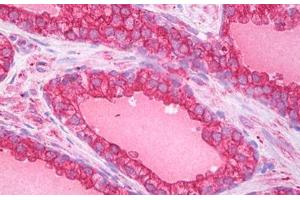 Anti-ATG5 antibody IHC staining of human prostate. (ATG5 Antikörper  (AA 8-318))