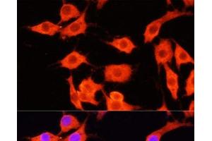 Immunofluorescence analysis of PC-12 cells using SERPINA12 Polyclonal Antibody at dilution of 1:100 (40x lens).