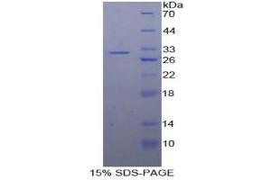 SDS-PAGE (SDS) image for Signal Transducer and Activator of Transcription 2, 113kDa (STAT2) (AA 616-849) protein (His tag) (ABIN1879276)