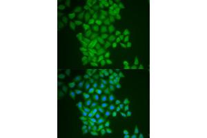 Immunofluorescence analysis of MCF-7 cell using FTH1 antibody. (FTH1 Antikörper)
