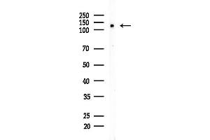 Western blot analysis of lysates from 3-L1 P6(heat-shock,45 min treatment), using MSH3 Antibody at 1/1000 dilution.