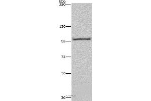 Western blot analysis of Raji cell, using NEDD9 Polyclonal Antibody at dilution of 1:650 (NEDD9 Antikörper)