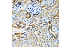 Immunohistochemistry of paraffin-embedded rat kidney using CASP3 antibody. (Caspase 3 Antikörper)