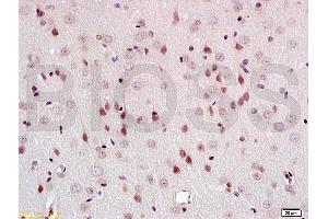 Formalin-fixed and paraffin embedded rat brain tissue labeled with Anti-PEG3 Polyclonal Antibody, Unconjugated (ABIN735653) at 1:200 followed by conjugation to the secondary antibody and DAB staining