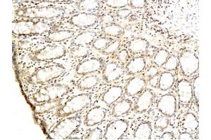 Formalin-fixed and paraffin embedded rat colon labeled with Anti-TGF alpha Polyclonal Antibody Unconjugated (ABIN724415) followed by conjugation to the secondary antibody and DAB staining (TGFA Antikörper  (AA 40-89))