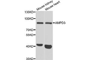 Western blot analysis of extracts of various cell lines, using AMPD3 antibody (ABIN5973764) at 1/1000 dilution. (AMPD3 Antikörper)