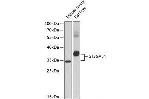 Western blot analysis of extracts of various cell lines using ST3GAL4 Polyclonal Antibody at dilution of 1:1000. (ST3GAL4 Antikörper)