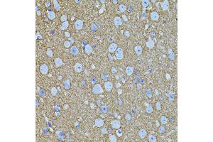 Immunohistochemistry of paraffin-embedded mouse brain using STX1A antibody (ABIN5995405) (40x lens). (STX1A Antikörper)