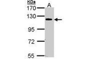 Image no. 1 for anti-Caspase Recruitment Domain Family, Member 10 (CARD10) (AA 341-600) antibody (ABIN467541) (CARD10 Antikörper  (AA 341-600))