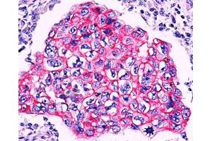 Immunohistochemistry (IHC) image for anti-Catenin, beta (CATNB) antibody (ABIN3024225)