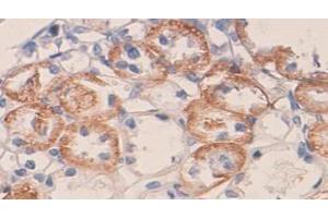 IHC staining of formalin-fixed paraffin-embedded rat kidney with VEGF protein staining, using VEGF antibody (1/100 dilution). (VEGF Antikörper  (N-Term))