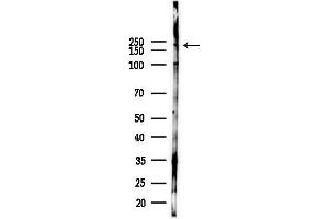 anti-Myosin Heavy Chain 15 (MYH15) (Internal Region) antibody