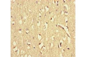 Immunohistochemistry of paraffin-embedded human brain tissue using ABIN7175867 at dilution of 1:100 (WAC Antikörper  (AA 10-102))