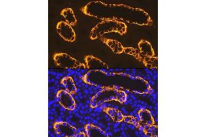 Immunofluorescence analysis of rat kidney using PDZK1 Rabbit mAb (ABIN7269199) at dilution of 1:100 (40x lens). (PDZK1 Antikörper)