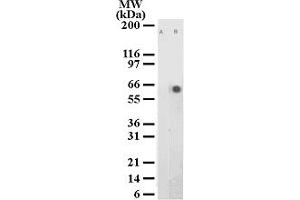 Image no. 1 for anti-Activating Transcription Factor 2 (ATF2) (pThr71) antibody (ABIN208166) (ATF2 Antikörper  (pThr71))