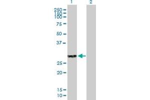 Western Blot analysis of CLEC4A expression in transfected 293T cell line by CLEC4A MaxPab polyclonal antibody. (CLEC4A Antikörper  (AA 1-237))
