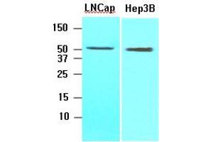 Western Blotting (WB) image for anti-Acyl-CoA Thioesterase 11 (ACOT11) antibody (ABIN306469) (ACOT11 Antikörper)